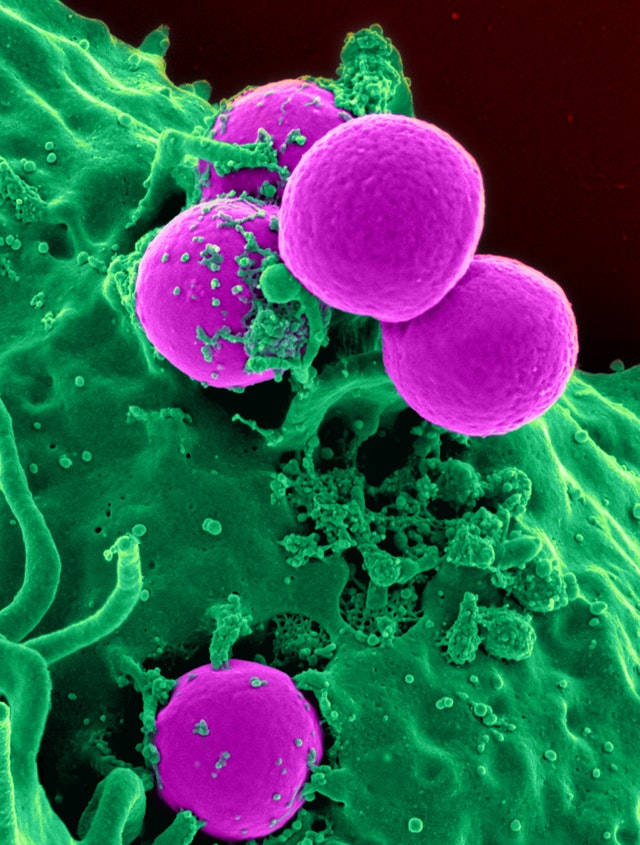 Read more about the article How many microbes live on us?